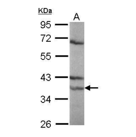 Retinoic Acid Receptor alpha Antibody from Signalway Antibody (35355) - Antibodies.com