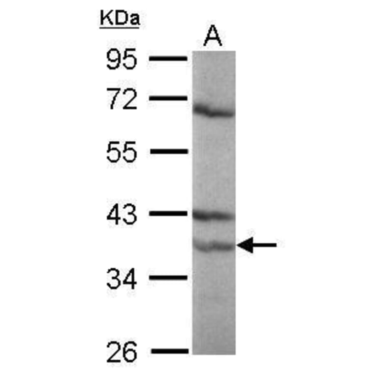 Retinoic Acid Receptor alpha Antibody from Signalway Antibody (35355) - Antibodies.com