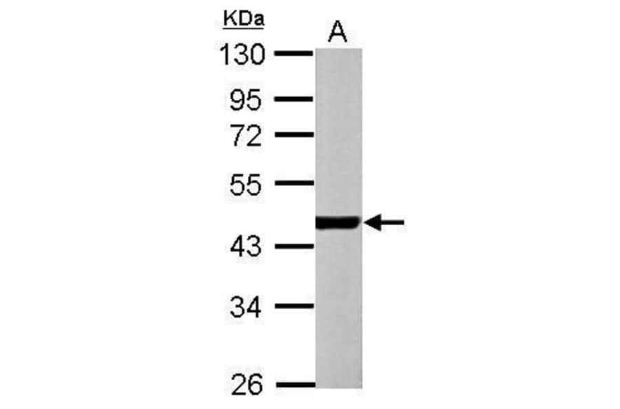 alpha Actin (cardiac muscle) Antibody from Signalway Antibody (35382) - Antibodies.com