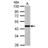 alpha Actin (cardiac muscle) Antibody from Signalway Antibody (35382) - Antibodies.com