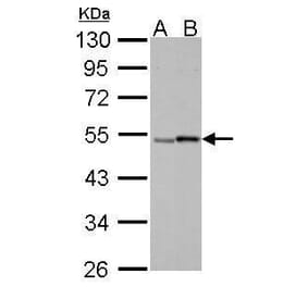 Retinoic Acid Receptor gamma Antibody from Signalway Antibody (35399) - Antibodies.com