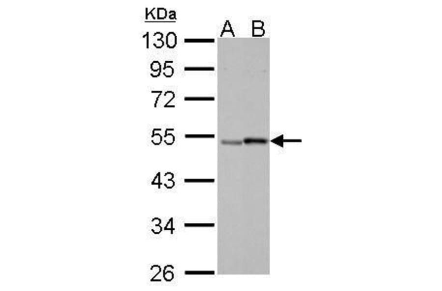 Retinoic Acid Receptor gamma Antibody from Signalway Antibody (35399) - Antibodies.com