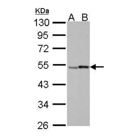 Retinoic Acid Receptor gamma Antibody from Signalway Antibody (35399) - Antibodies.com