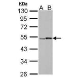 Retinoic Acid Receptor gamma Antibody from Signalway Antibody (35399) - Antibodies.com