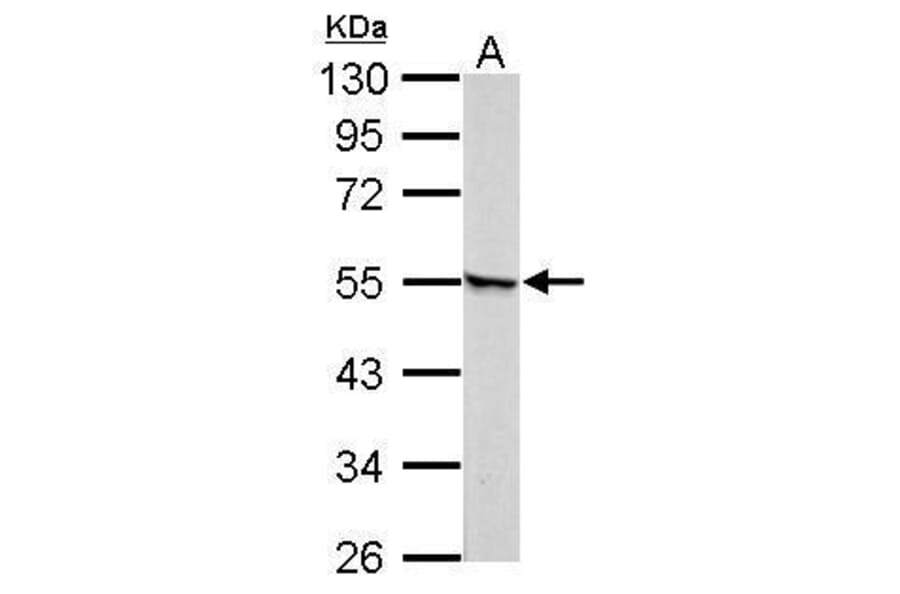 Retinoic Acid Receptor gamma Antibody from Signalway Antibody (35399) - Antibodies.com