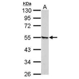 Retinoic Acid Receptor gamma Antibody from Signalway Antibody (35399) - Antibodies.com