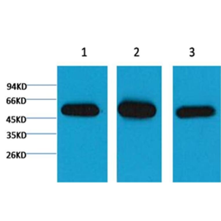 Western blot - β I tubulin Mouse Monoclonal Antibody from Signalway Antibody (37983) - Antibodies.com