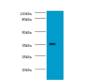 Docking protein 5 Polyclonal Antibody from Signalway Antibody (42152) - Antibodies.com