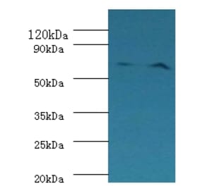 Plasma kallikrein Polyclonal Antibody from Signalway Antibody (42232) - Antibodies.com