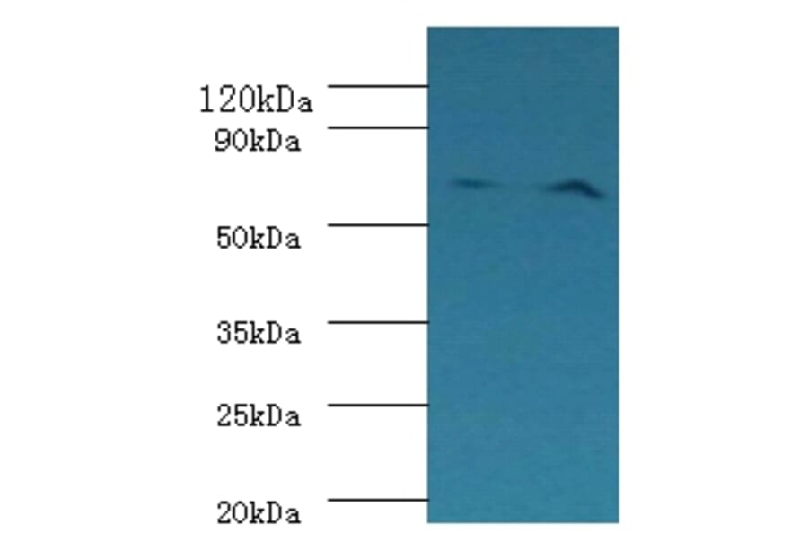 Plasma kallikrein Polyclonal Antibody from Signalway Antibody (42232) - Antibodies.com
