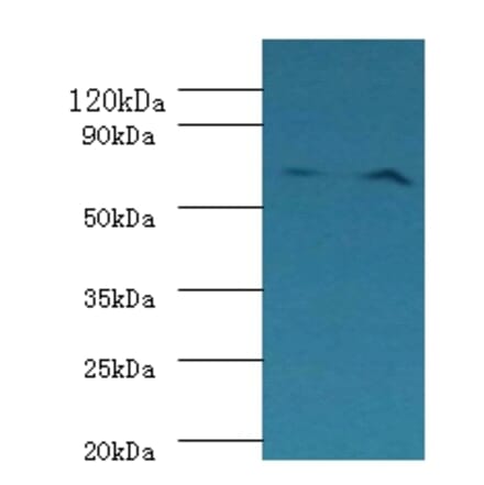 Plasma kallikrein Polyclonal Antibody from Signalway Antibody (42232) - Antibodies.com