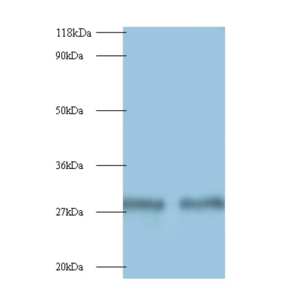 Myelin protein P0 Polyclonal Antibody from Signalway Antibody (42495) - Antibodies.com