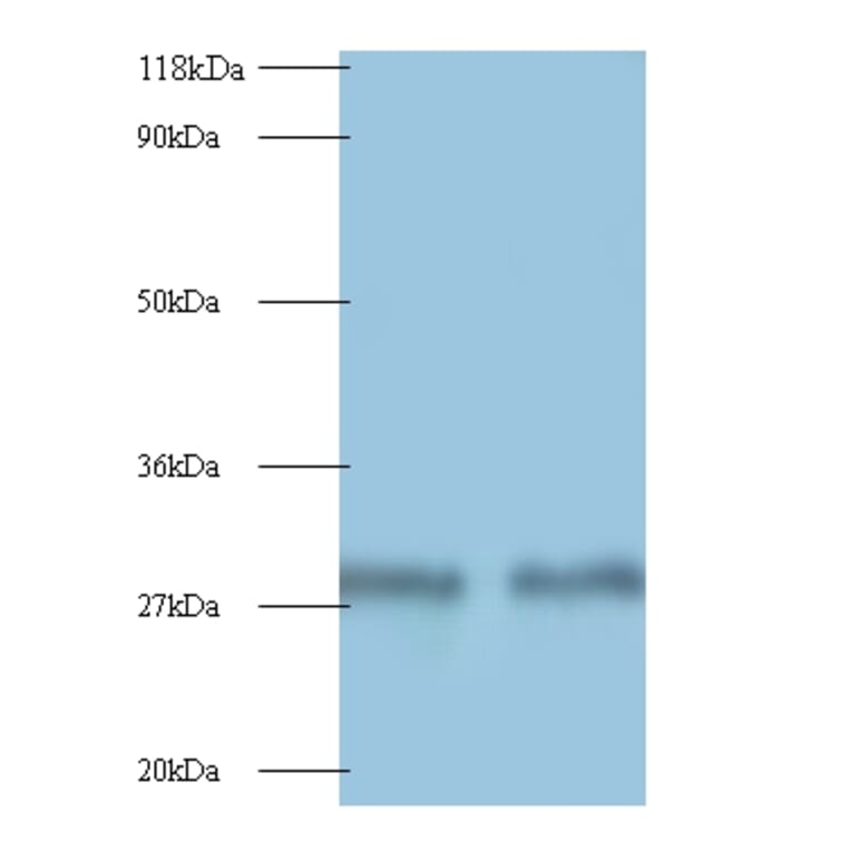 Myelin protein P0 Polyclonal Antibody from Signalway Antibody (42495) - Antibodies.com