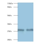 Myelin protein P0 Polyclonal Antibody from Signalway Antibody (42495) - Antibodies.com