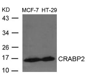Western blot - CRABP2 Antibody from Signalway Antibody (21647) - Antibodies.com