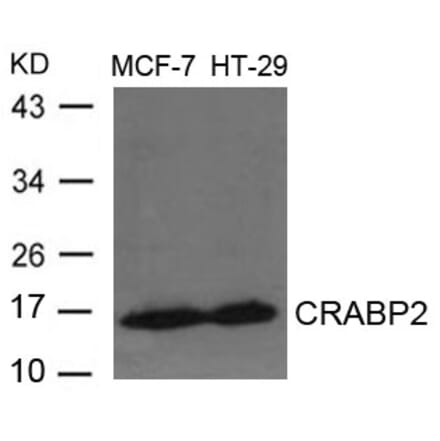 Western blot - CRABP2 Antibody from Signalway Antibody (21647) - Antibodies.com