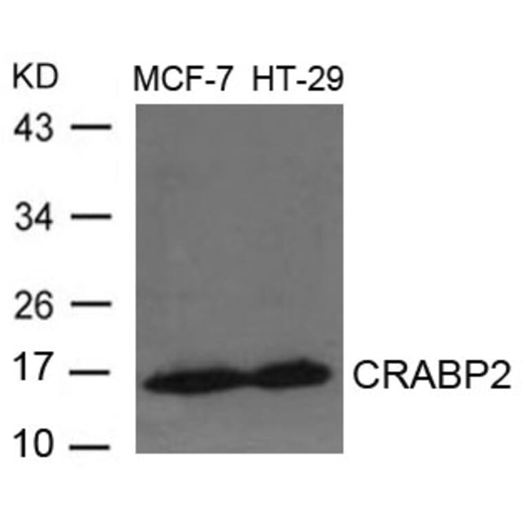 Western blot - CRABP2 Antibody from Signalway Antibody (21647) - Antibodies.com