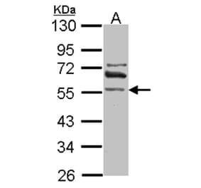 ALDH1A2 antibody from Signalway Antibody (22039) - Antibodies.com