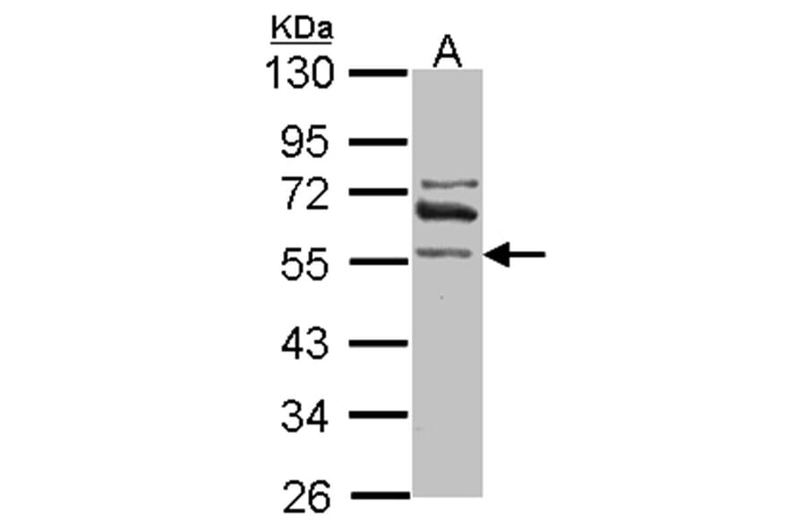 ALDH1A2 antibody from Signalway Antibody (22039) - Antibodies.com