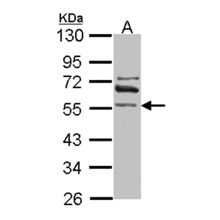 ALDH1A2 antibody from Signalway Antibody (22039) - Antibodies.com