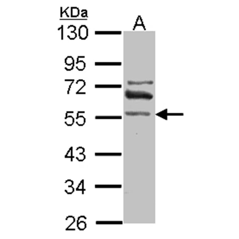 ALDH1A2 antibody from Signalway Antibody (22039) - Antibodies.com