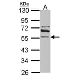 ALDH1A2 antibody from Signalway Antibody (22039) - Antibodies.com