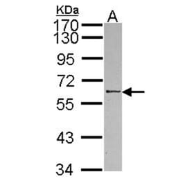 RBMY1A1 antibody from Signalway Antibody (22122) - Antibodies.com