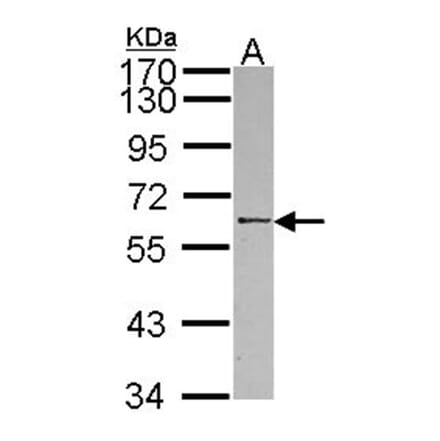 RBMY1A1 antibody from Signalway Antibody (22122) - Antibodies.com