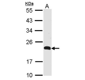 CKLFSF5 antibody from Signalway Antibody (22137) - Antibodies.com