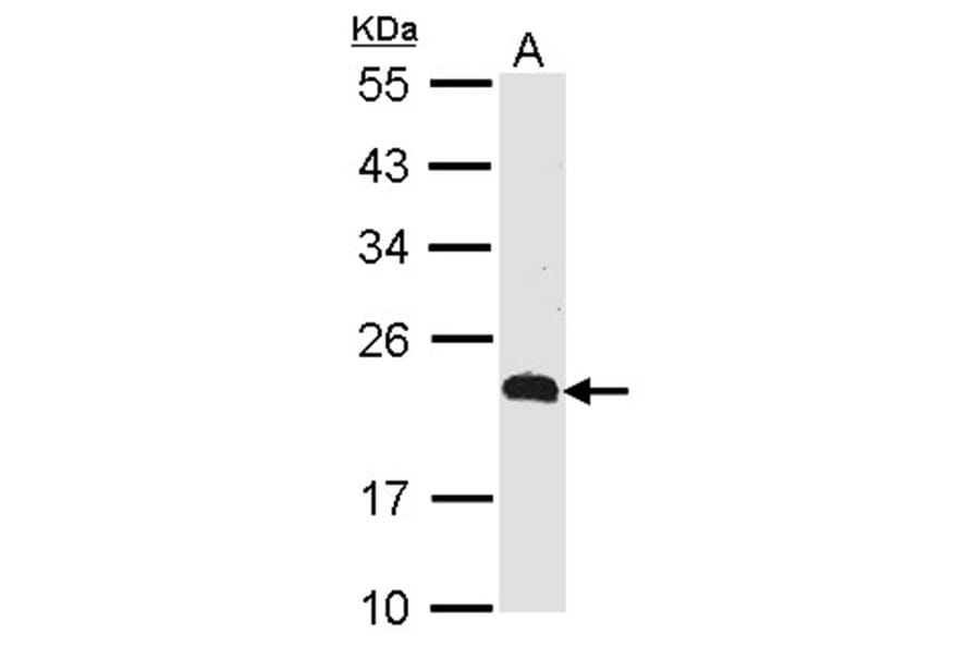 CKLFSF5 antibody from Signalway Antibody (22137) - Antibodies.com