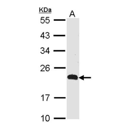 CKLFSF5 antibody from Signalway Antibody (22137) - Antibodies.com