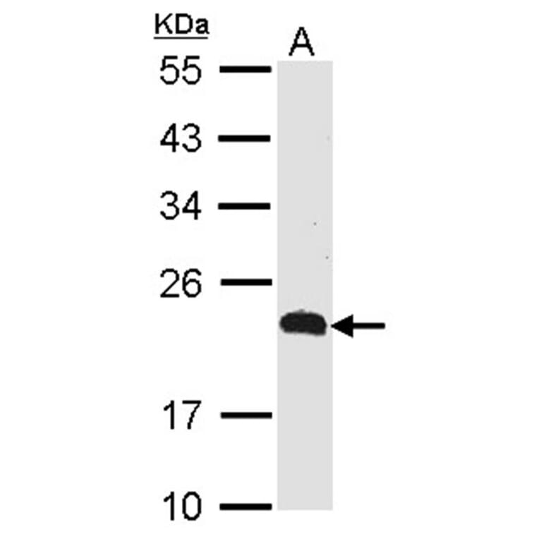 CKLFSF5 antibody from Signalway Antibody (22137) - Antibodies.com