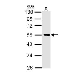 ALDH3B2 antibody from Signalway Antibody (22169) - Antibodies.com