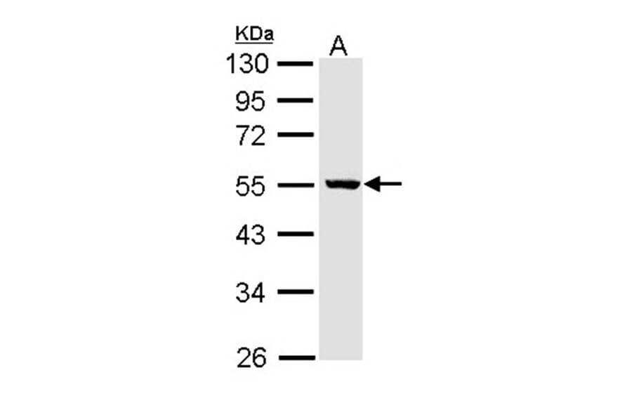 ALDH3B2 antibody from Signalway Antibody (22169) - Antibodies.com