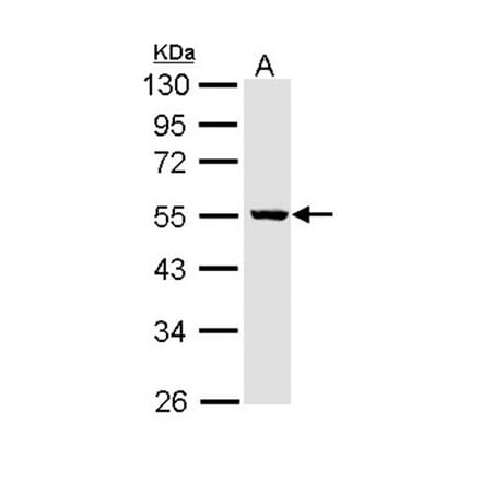 ALDH3B2 antibody from Signalway Antibody (22169) - Antibodies.com