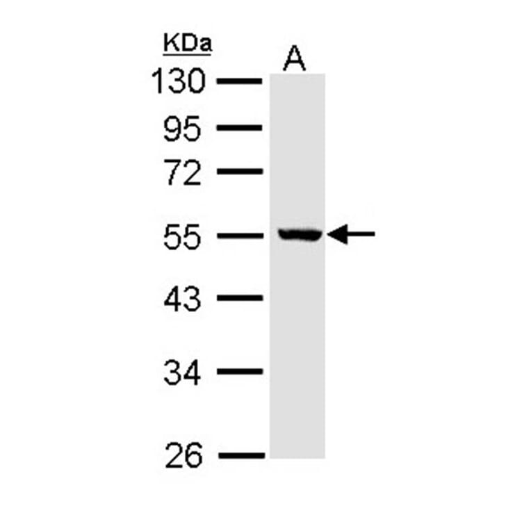 ALDH3B2 antibody from Signalway Antibody (22169) - Antibodies.com