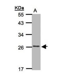 CKLFSF5 antibody from Signalway Antibody (22184) - Antibodies.com