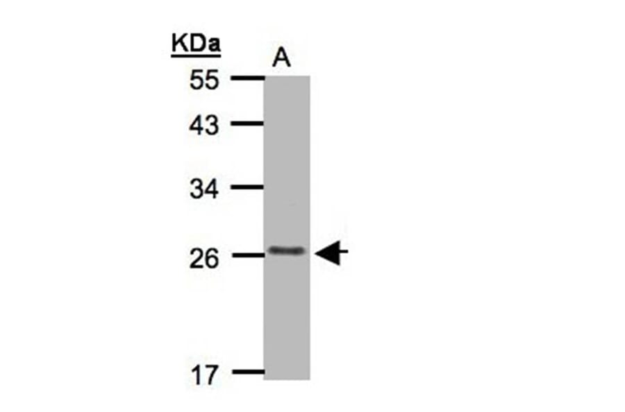 CKLFSF5 antibody from Signalway Antibody (22184) - Antibodies.com