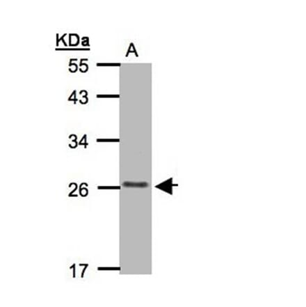 CKLFSF5 antibody from Signalway Antibody (22184) - Antibodies.com