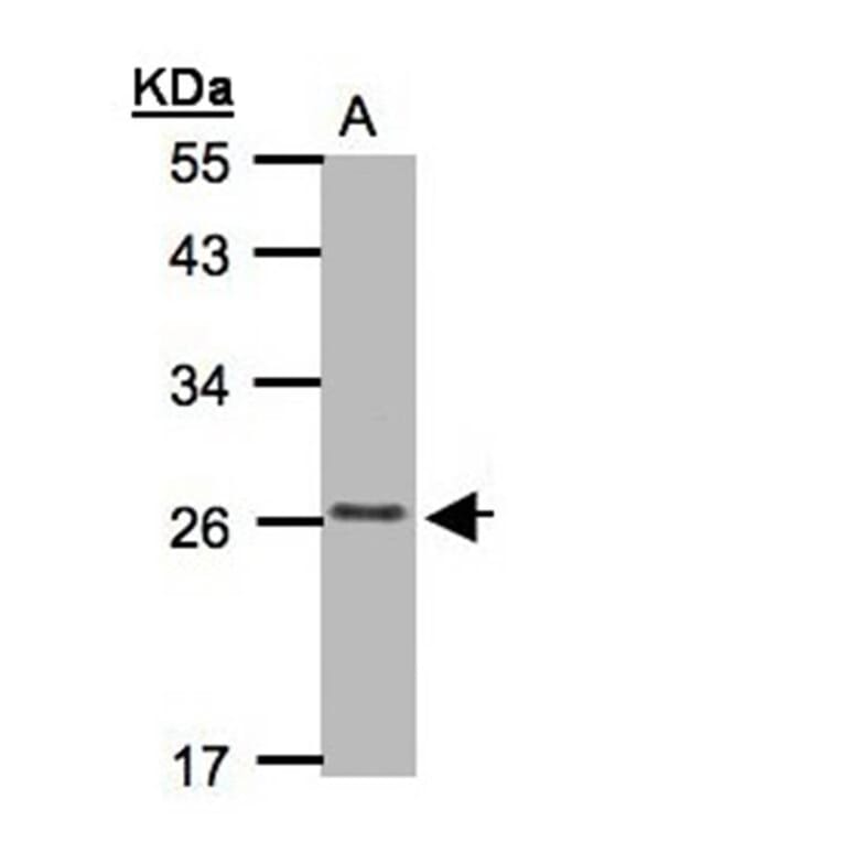 CKLFSF5 antibody from Signalway Antibody (22184) - Antibodies.com