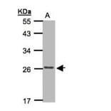 CKLFSF5 antibody from Signalway Antibody (22184) - Antibodies.com