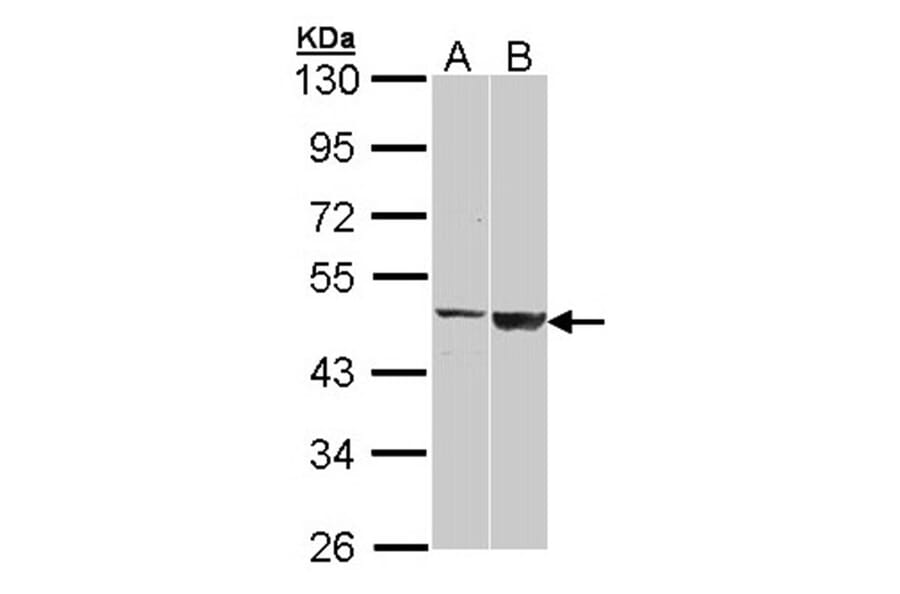 GAL3ST1 antibody from Signalway Antibody (22209) - Antibodies.com