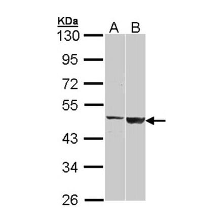 GAL3ST1 antibody from Signalway Antibody (22209) - Antibodies.com