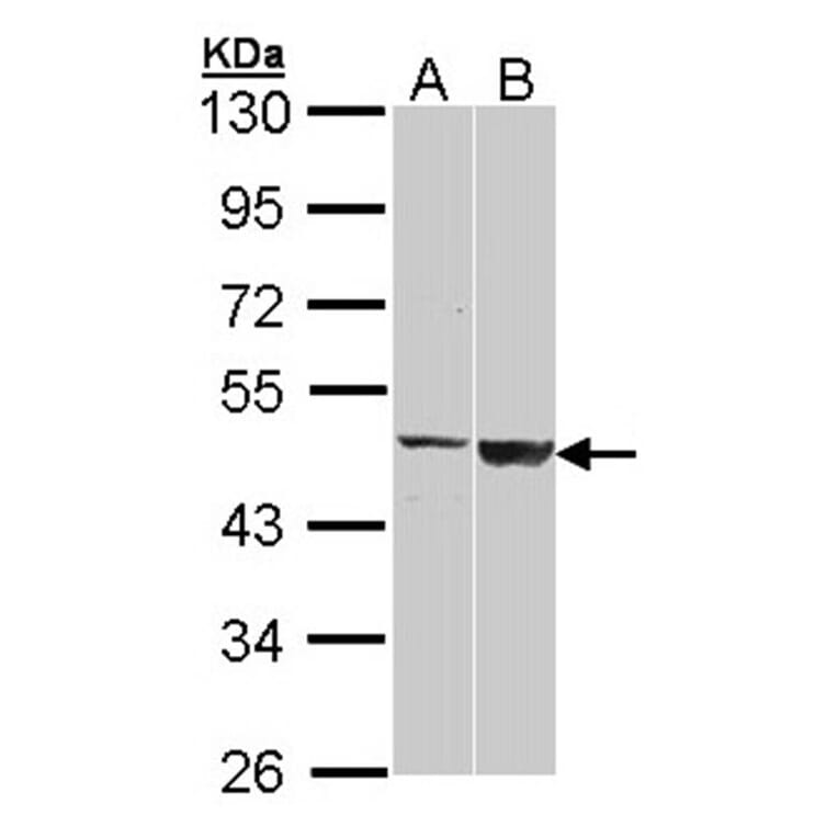 GAL3ST1 antibody from Signalway Antibody (22209) - Antibodies.com