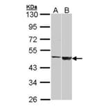 GAL3ST1 antibody from Signalway Antibody (22209) - Antibodies.com