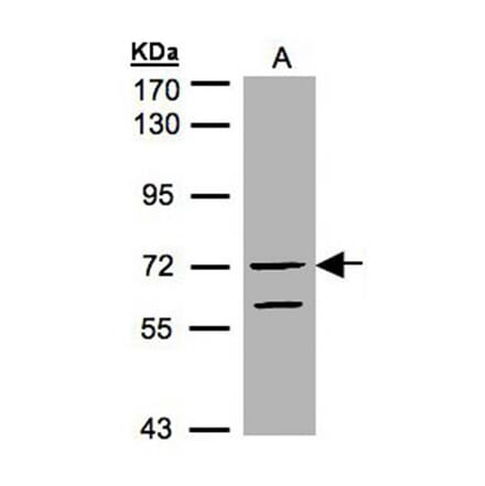 RAPGEF5 antibody from Signalway Antibody (22286) - Antibodies.com