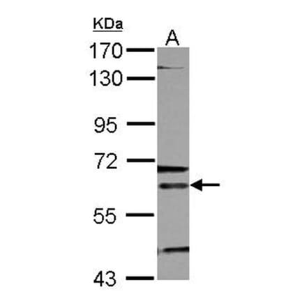 ALAS-E antibody from Signalway Antibody (22293) - Antibodies.com