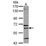 ALAS-E antibody from Signalway Antibody (22293) - Antibodies.com