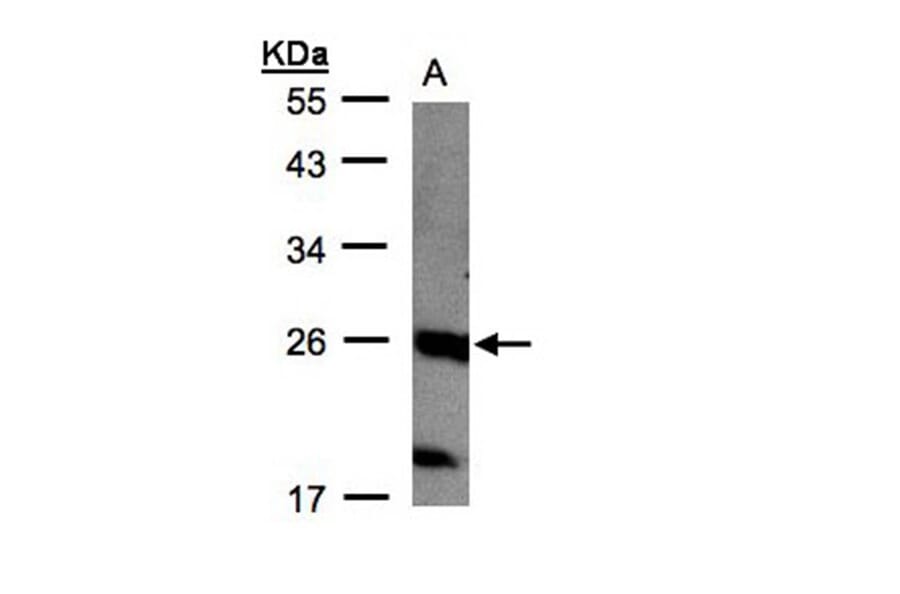 C1orf57 antibody from Signalway Antibody (22295) - Antibodies.com