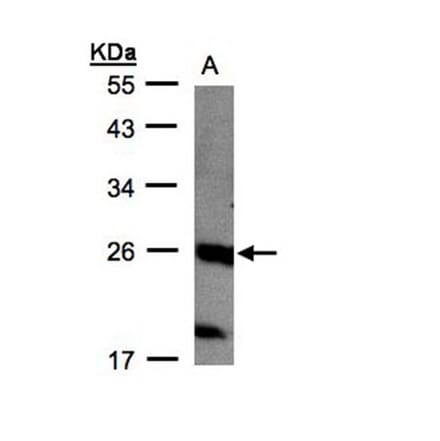 C1orf57 antibody from Signalway Antibody (22295) - Antibodies.com
